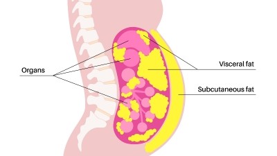 Fat accumulation around the abdominal viscera is a major risk factor for systemic inflammation and metabolic disorders, among other conditions. ©Getty Images